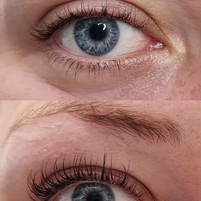 lash lifting