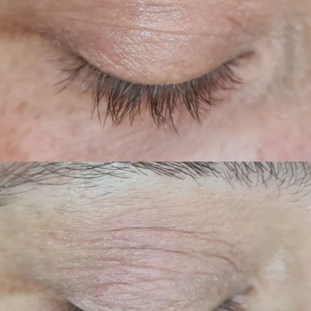 lash lifting