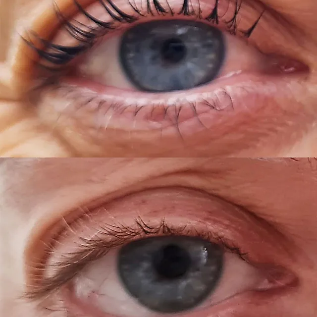 lash lifting